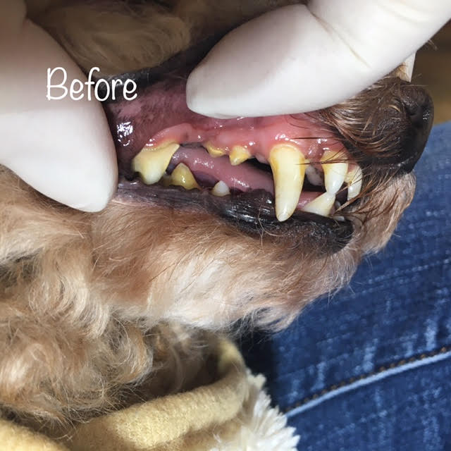 Before Before
