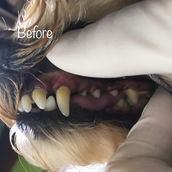 Before Before