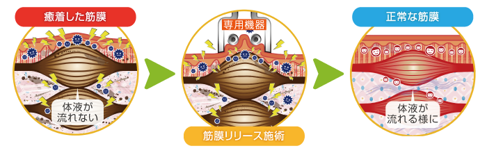 施術の流れ 施術の流れ